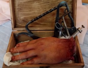 Amputación. Kit de sierra e instrumental quirúrgico. Estilo medieval.