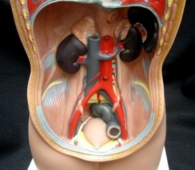 Modelo anatómico de cadera y muslo con celulitis