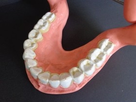 Modelo anatómico de conjunto de dientes. USO DIDÁCTICO.