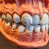 Modelo anatómico de conjunto de dientes. USO DIDÁCTICO.