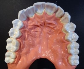 Modelo anatómico de conjunto de dientes. USO DIDÁCTICO.