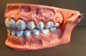 Modelo anatómico de conjunto de dientes. USO DIDÁCTICO.