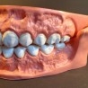 Modelo anatómico de conjunto de dientes. USO DIDÁCTICO.