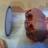 Cráneo de feto unido de siameses. Réplica. Cráneo infantil.