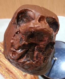 Feto humano de siameses. Cráneo doble anatómicamente correcto. Curiosas calaveras.