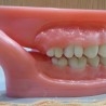 Dentadura. Modelo anatómico de conjunto de dientes. USO DIDÁCTICO.