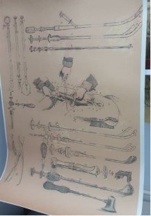 Lámina instrumental médico finales de 1800. Enmarcada y acristalada