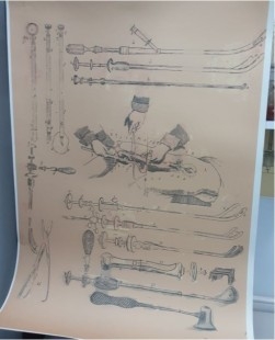 Lámina instrumental médico finales de 1800. Enmarcada y acristalada