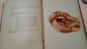 Atlas de Sífilis y Enfermedades Venéreas. Año 1902. Libro centenario.