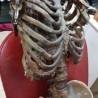 Esqueleto humano en descomposición. Réplica.