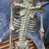 Esqueleto Infantil de Siameses. Réplica.